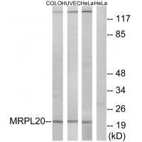 MRPL20 Antibody in Western Blot (WB)