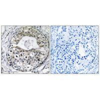 RPS13 Antibody in Immunohistochemistry (Paraffin) (IHC (P))