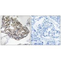 RPS25 Antibody in Immunohistochemistry (Paraffin) (IHC (P))