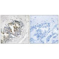 RPLP2 Antibody in Immunohistochemistry (Paraffin) (IHC (P))