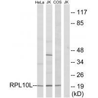 RPL10L Antibody in Western Blot (WB)