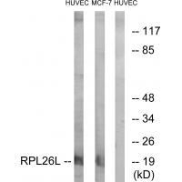 RPL26L1 Antibody in Western Blot (WB)