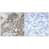 RPL3 Antibody in Immunohistochemistry (Paraffin) (IHC (P))