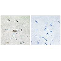 RPL39L Antibody in Immunohistochemistry (Paraffin) (IHC (P))