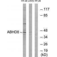 ABHD8 Antibody in Western Blot (WB)