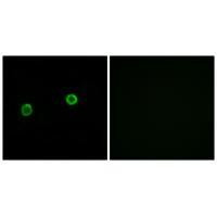 ACOT4 Antibody in Immunocytochemistry (ICC/IF)