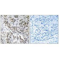 APBB2 Antibody in Immunohistochemistry (Paraffin) (IHC (P))