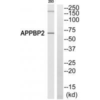 PAT1 Antibody in Western Blot (WB)