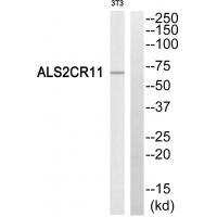 ALS2CR11 Antibody in Western Blot (WB)