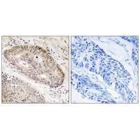 CARF Antibody in Immunohistochemistry (Paraffin) (IHC (P))