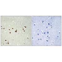 ANKRD26 Antibody in Immunohistochemistry (Paraffin) (IHC (P))