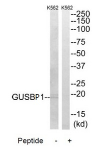GUSBP1 Antibody in Western Blot (WB)