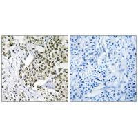 CAGE1 Antibody in Immunohistochemistry (Paraffin) (IHC (P))