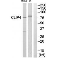 CLIP4 Antibody in Western Blot (WB)