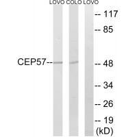 CEP57 Antibody in Western Blot (WB)