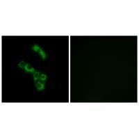 C1QB Antibody in Immunocytochemistry (ICC/IF)