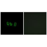 CSTL1 Antibody in Immunocytochemistry (ICC/IF)