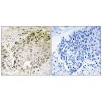 RFX2 Antibody in Immunohistochemistry (Paraffin) (IHC (P))