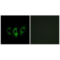 GFM2 Antibody in Immunocytochemistry (ICC/IF)