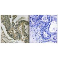 Aldolase C Antibody in Immunohistochemistry (Paraffin) (IHC (P))
