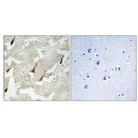 GPRIN2 Antibody in Immunohistochemistry (Paraffin) (IHC (P))