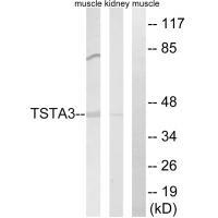 TSTA3 Antibody in Western Blot (WB)