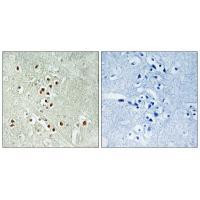 GADD45GIP1 Antibody in Immunohistochemistry (Paraffin) (IHC (P))