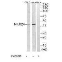 Nkx2.4 Antibody in Western Blot (WB)
