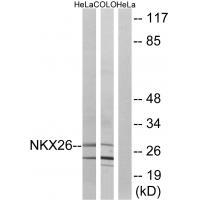 Nkx2.6 Antibody in Western Blot (WB)