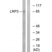 LRP3 Antibody in Western Blot (WB)