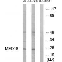 MED18 Antibody in Western Blot (WB)