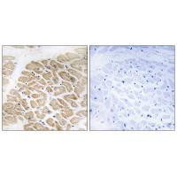 MIA Antibody in Immunohistochemistry (Paraffin) (IHC (P))