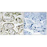 MRPL42 Antibody in Immunohistochemistry (Paraffin) (IHC (P))
