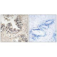 MRPS36 Antibody in Immunohistochemistry (Paraffin) (IHC (P))