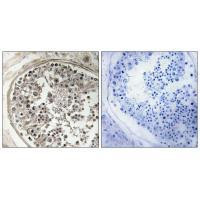 MRPS5 Antibody in Immunohistochemistry (Paraffin) (IHC (P))