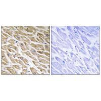 MRPL39 Antibody in Immunohistochemistry (Paraffin) (IHC (P))