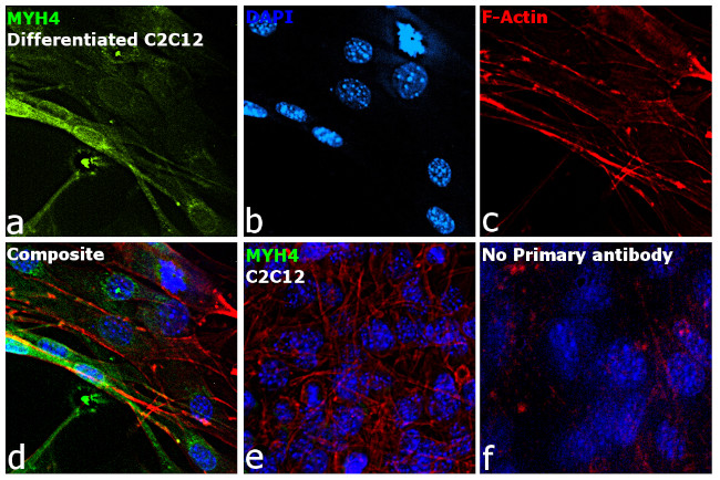 Myosin 4 Antibody in Immunocytochemistry (ICC/IF)