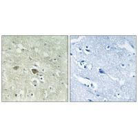 NDUFV3 Antibody in Immunohistochemistry (Paraffin) (IHC (P))
