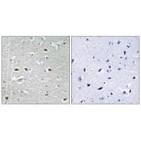 URB1 Antibody in Immunohistochemistry (Paraffin) (IHC (P))