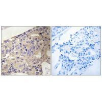 PEX10 Antibody in Immunohistochemistry (Paraffin) (IHC (P))