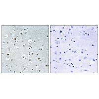 PPRC1 Antibody in Immunohistochemistry (Paraffin) (IHC (P))