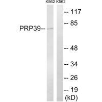 PRPF39 Antibody in Western Blot (WB)