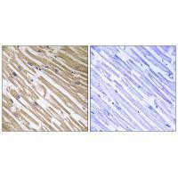 NDRG4 Antibody in Immunohistochemistry (Paraffin) (IHC (P))