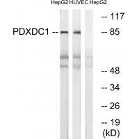 PDXDC1 Antibody in Western Blot (WB)