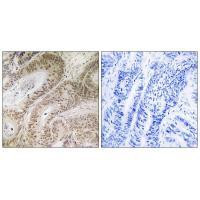 RDM1 Antibody in Immunohistochemistry (Paraffin) (IHC (P))