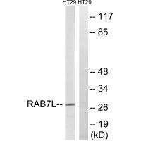 RAB29 Antibody in Western Blot (WB)
