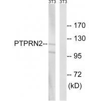 PTPRN2 Antibody in Western Blot (WB)