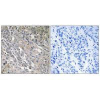 ARHGEF9 Antibody in Immunohistochemistry (Paraffin) (IHC (P))