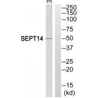 Septin-14 Antibody in Western Blot (WB)