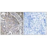 SPINK6 Antibody in Immunohistochemistry (Paraffin) (IHC (P))